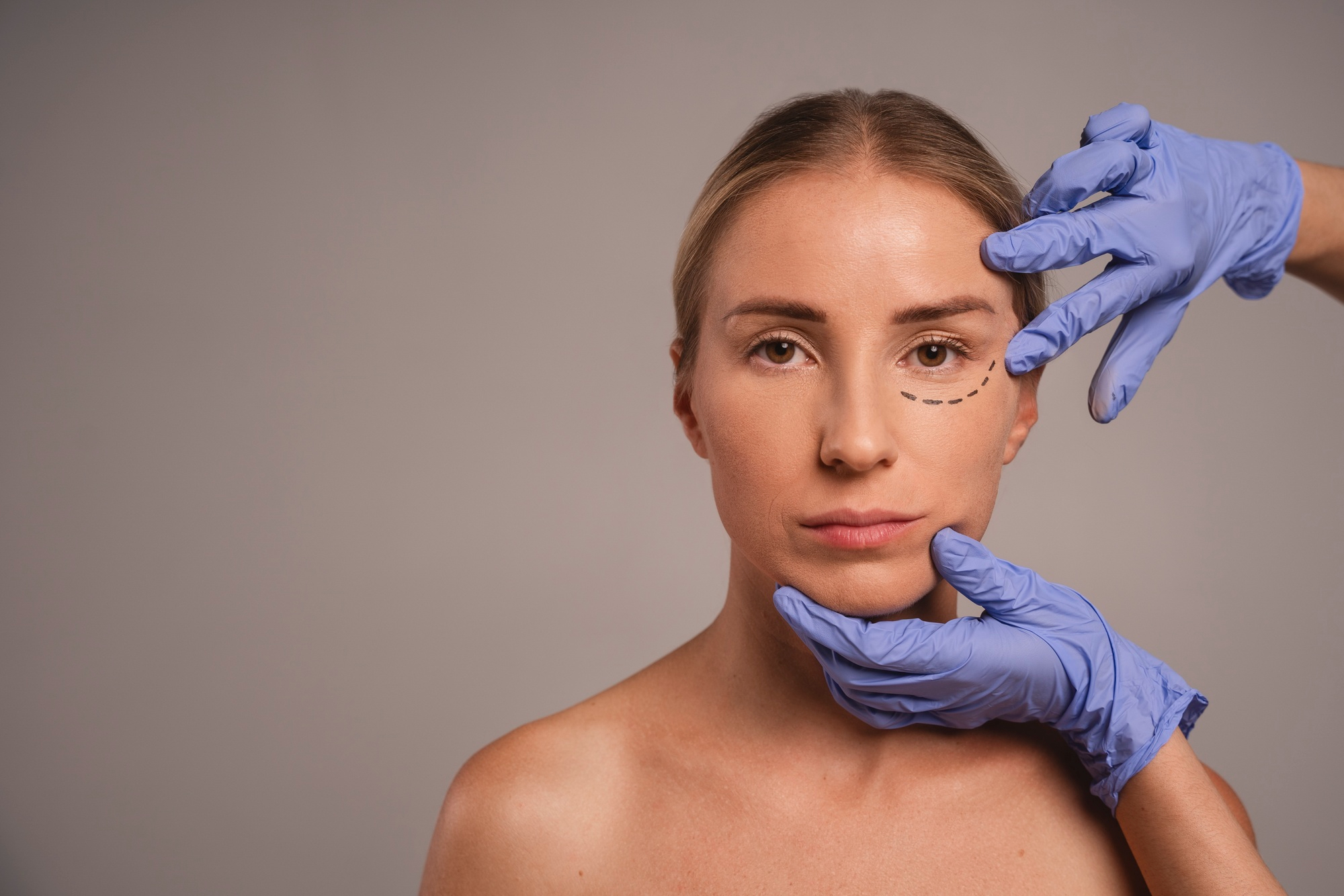 Scar Treatment