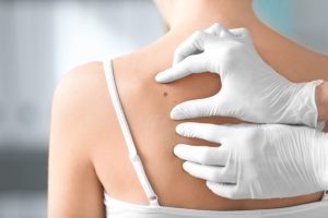 Skin Biopsy