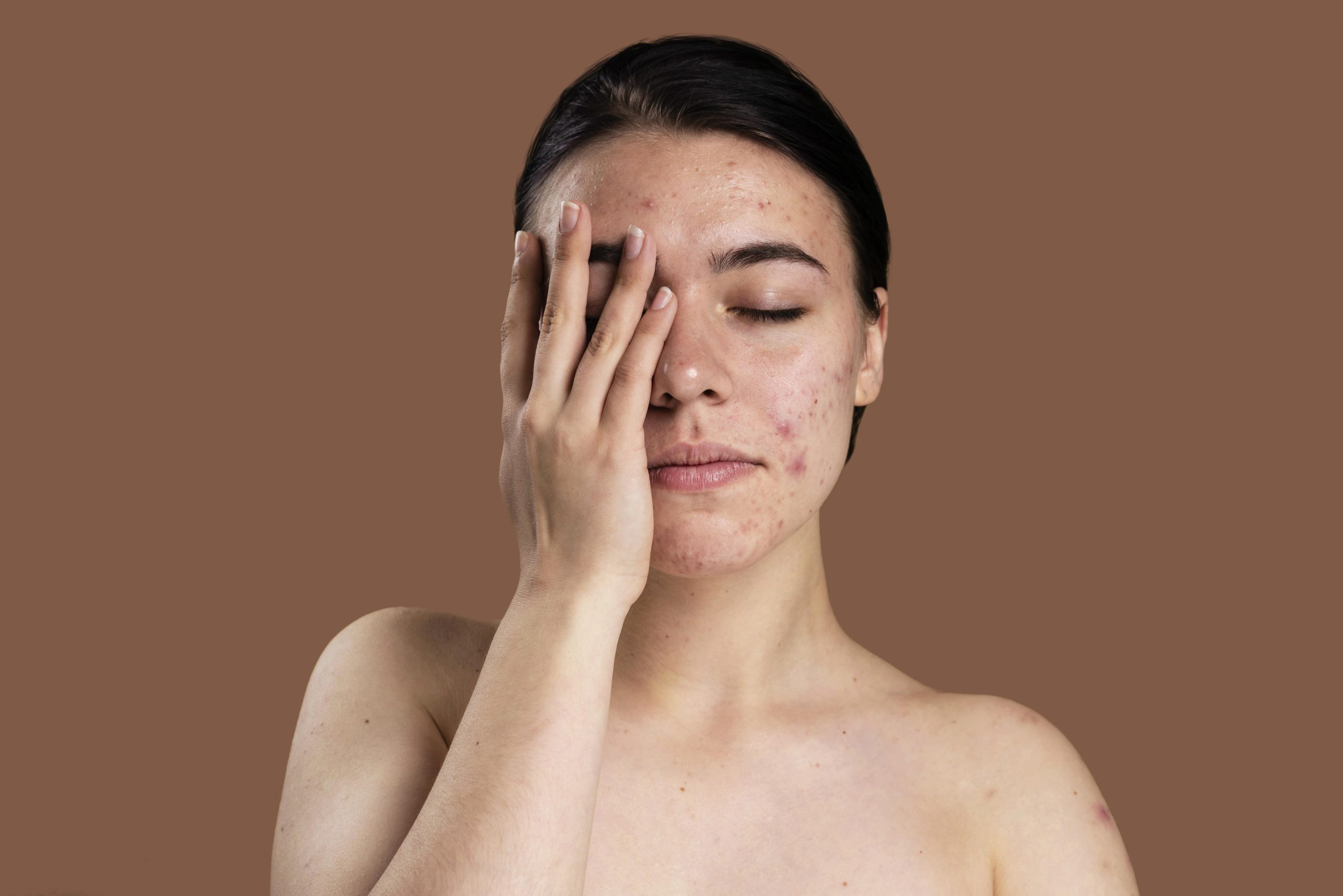 Scar Treatment